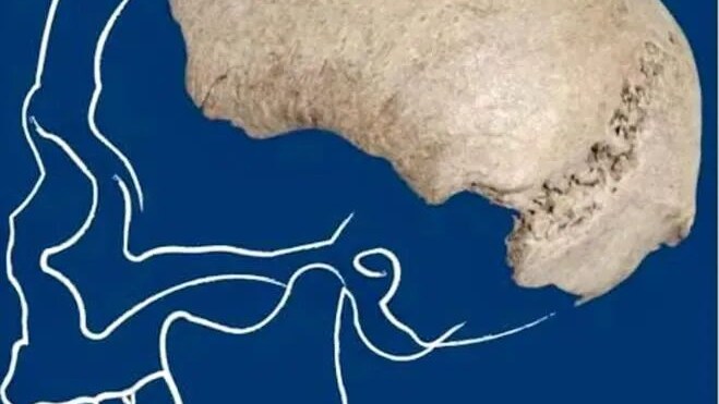 cranio homo sapiens