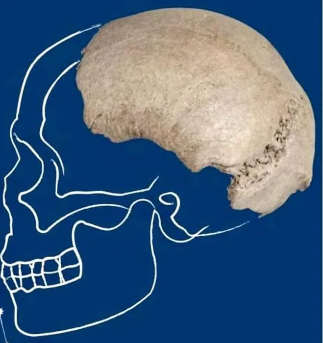 cranio homo sapiens